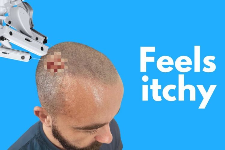 Elon’s AI Brain Chip Injected into First Human: SHOCKING Results