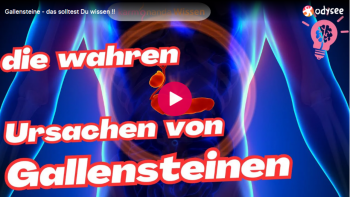 Gallensteine – das solltest Du wissen !!