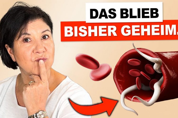 Heißhunger auf Süßigkeiten: Parasitenbefall? (54% sind betroffen)