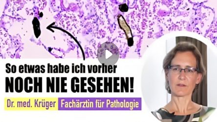 Todesfälle durch die giftige Corona impfung