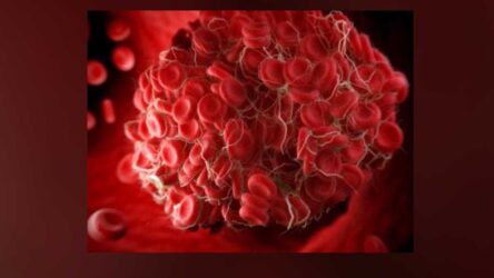 VERDORBENES BLUT: 80 % der Blutvorräte sind mit Spike-Proteinen aus mRNA-Spritzen kontaminiert, geben Blutbanken versehentlich zu