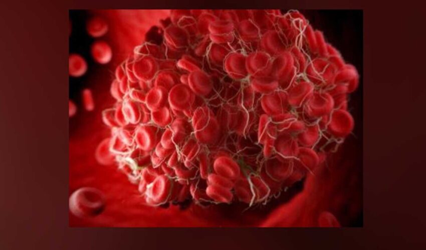 VERDORBENES BLUT: 80 % der Blutvorräte sind mit Spike-Proteinen aus mRNA-Spritzen kontaminiert, geben Blutbanken versehentlich zu